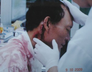 The doctored photograph of  Nguyen Manh Diep’s injuries